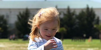 down's syndrome