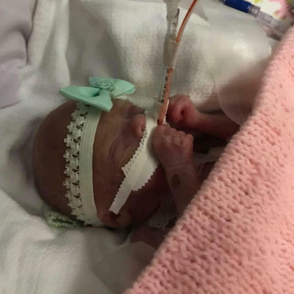We're In Love With Our New Rainbow Girl But We Will Never Forget The Baby We Lost - we re looking forward to meeting our rainbow baby girl but we will never forget the baby we lost 4 420x420
