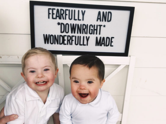 Down Syndrome, Adoption, Seven Kids – They Weren’t In My Life Plan, But I Wouldn’t Change A Thing - down syndrome adoption seven kids they werent in my life plan but i wouldnt change a thing 9 561x420