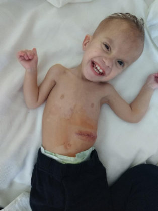 Our Tiny Son’s Condition Is So Rare, It Doesn’t Have A Name - Kassy Stuart 084232 314x420