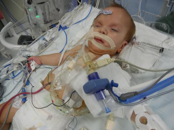 Our Tiny Son’s Condition Is So Rare, It Doesn’t Have A Name - Kassy Stuart 080858 563x420
