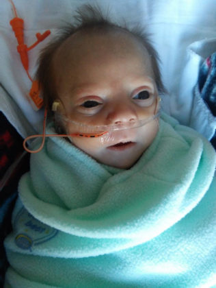 Our Tiny Son’s Condition Is So Rare, It Doesn’t Have A Name - Kassy Stuart 074724 316x420