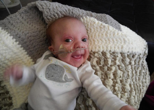 Our Tiny Son’s Condition Is So Rare, It Doesn’t Have A Name - Kassy Stuart 075857 586x420